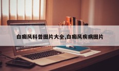白癜风科普图片大全,白癜风疾病图片