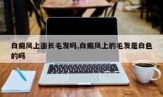 白癜风上面长毛发吗,白癜风上的毛发是白色的吗
