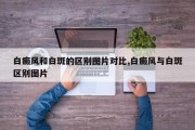 白癜风和白斑的区别图片对比,白癜风与白斑区别图片