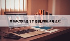 白癜风发红是什么原因,白癜风处泛红