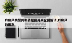 白癜风类型判断依据图片大全图解法,白癜风的形态