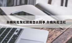 白癜风处发红脱皮怎么回事,白癜风处泛红