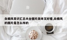 白癜风常识汇总大全图片简单又好看,白癜风的图片是怎么样的
