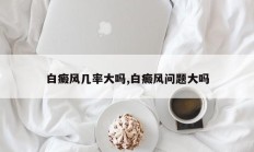 白癜风几率大吗,白癜风问题大吗