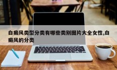 白癜风类型分类有哪些类别图片大全女性,白癜风的分类