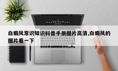 白癜风常识知识科普手册图片高清,白癜风的图片看一下