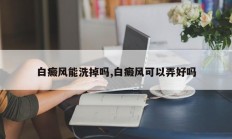 白癜风能洗掉吗,白癜风可以弄好吗