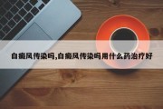 白癜风传染吗,白癜风传染吗用什么药治疗好