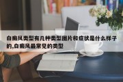 白癜风类型有几种类型图片和症状是什么样子的,白癜风最常见的类型