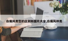 白癜风类型的区别和图片大全,白癜风种类