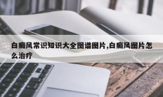 白癜风常识知识大全图谱图片,白癜风图片怎么治疗