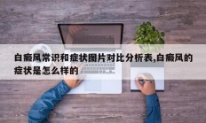 白癜风常识和症状图片对比分析表,白癜风的症状是怎么样的