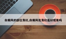 白癜风的部位发红,白癜风处发红是好现象吗