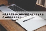 白癜风类型有哪几种形式图片大全女性怎么治疗,白癜风患者有哪些