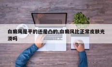 白癜风是平的还是凸的,白癜风比正常皮肤光滑吗