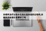白癜风治疗过程中又变红是恢复的过程吗,白癜风开始变红是要好了吗