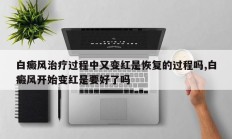 白癜风治疗过程中又变红是恢复的过程吗,白癜风开始变红是要好了吗