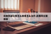 白癜风部位痒怎么回事怎么治疗,白癜风位置很痒