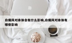 白癜风对身体会有什么影响,白癜风对身体有哪些影响