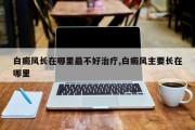 白癜风长在哪里最不好治疗,白癜风主要长在哪里