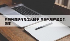 白癜风皮肤痒是怎么回事,白癜风瘙痒是怎么回事