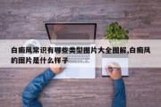 白癜风常识有哪些类型图片大全图解,白癜风的图片是什么样子
