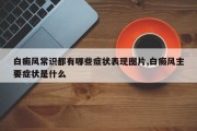 白癜风常识都有哪些症状表现图片,白癜风主要症状是什么