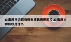 白癜风常识都有哪些症状表现图片,白癜风主要症状是什么