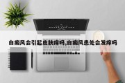 白癜风会引起皮肤痒吗,白癜风患处会发痒吗