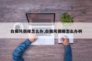 白癜风很痒怎么办,白癜风很痒怎么办啊