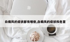 白癜风的症状都有哪些,白癜风的症状和危害