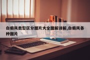 白癜风类型区分图片大全图解详解,白癜风各种图片