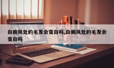 白癜风处的毛发会变白吗,白癜风处的毛发会变白吗