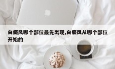 白癜风哪个部位最先出现,白癜风从哪个部位开始的