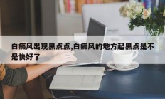 白癜风出现黑点点,白癜风的地方起黑点是不是快好了