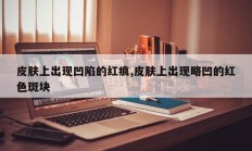 皮肤上出现凹陷的红痕,皮肤上出现略凹的红色斑块