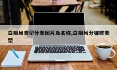 白癜风类型分类图片及名称,白癜风分哪些类型