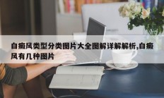 白癜风类型分类图片大全图解详解解析,白癜风有几种图片