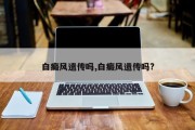 白癜风遗传吗,白癜风遗传吗?