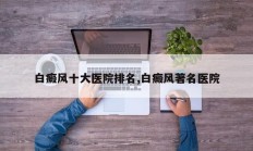 白癜风十大医院排名,白癜风著名医院
