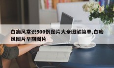 白癜风常识500例图片大全图解简单,白癜风图片早期图片