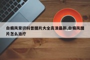 白癜风常识科普图片大全高清最新,白癜风图片怎么治疗