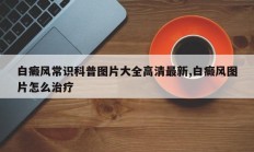 白癜风常识科普图片大全高清最新,白癜风图片怎么治疗