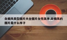 白癜风类型图片大全图片女性简单,白癜风的图片是什么样子