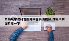 白癜风常识科普图片大全高清视频,白癜风的图片看一下