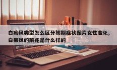 白癜风类型怎么区分初期症状图片女性变化,白癜风的前兆是什么样的