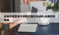 白癜风类型有几种形式图片组成的,白癜风的图案