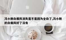 冯小刚白癜风消失是不是因为全白了,冯小刚的白癜风好了没有