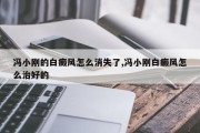 冯小刚的白癜风怎么消失了,冯小刚白癜风怎么治好的
