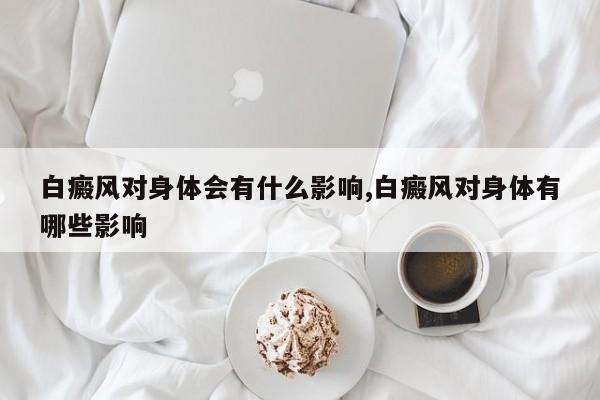 白癜风对身体会有什么影响,白癜风对身体有哪些影响